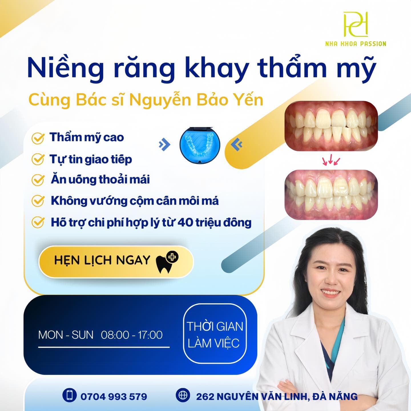 Case Implant toàn hàm